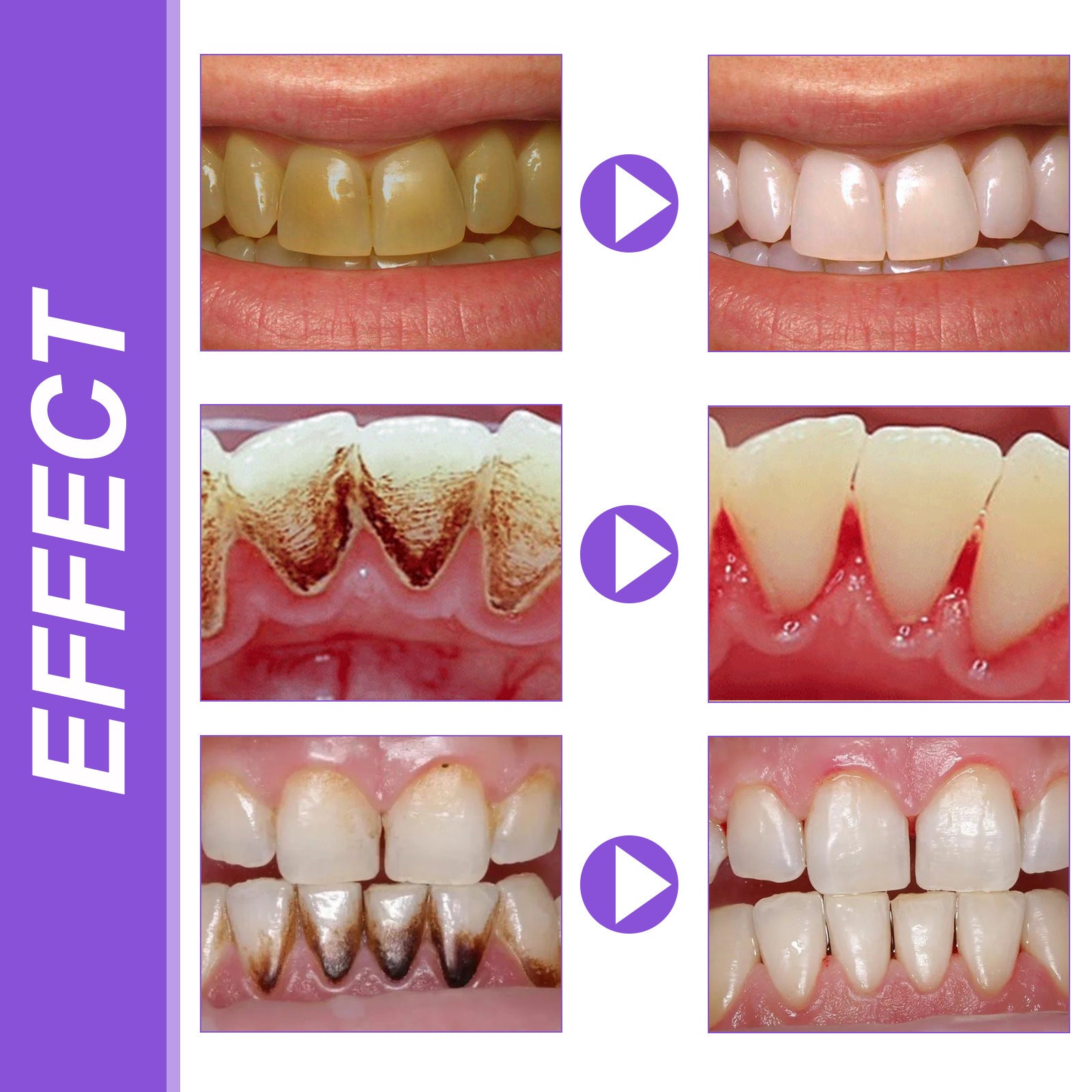 Teeth Whitening Essence
